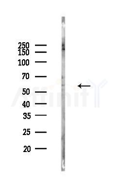 AMH Antibody - Western blot analysis of lysates from COLO205 cells(LPS, 4h treatment), using AMH Antibody at 1/1000 dilution.
