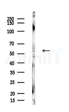 ESE1 Antibody - Western blot analysis of lysates from Hela cells(heat-shock,45min treatment), using ESE1 Antibody at 1/1000 dilution.