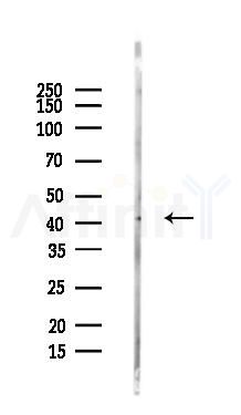 ESE1 Antibody - Western blot analysis of lysates from COLO205 cells(LPS, 4h treatment), using ESE1 Antibody at 1/1000 dilution.