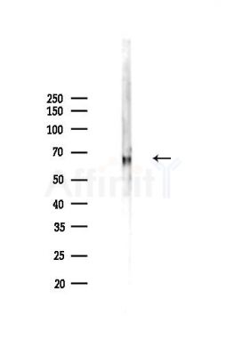 Proprotein Convertase 2 Antibody - Western blot analysis of lysates from Rat brain, using Proprotein Convertase 2 Antibody at 1/1000 dilution.