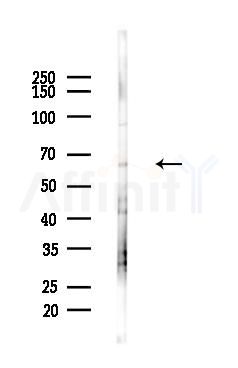 IL1RAP Antibody - Western blot analysis of lysates from Mouse liver, using IL1RAP Antibody at 1/1000 dilution.