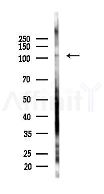 Epac2 Antibody - Western blot analysis of lysates from Mouse liver, using Epac2 Antibody at 1/1000 dilution.