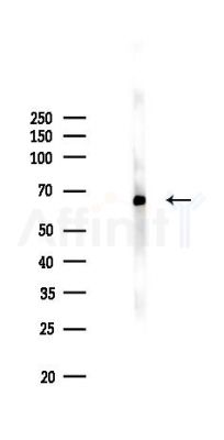 SNRP70 Antibody - Western blot analysis of lysates from Hela cells(LPS,4h treatment), using SNRP70 Antibody at 1/1000 dilution.