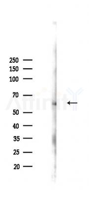 SNRP70 Antibody - Western blot analysis of lysates from Mouse lung, using SNRP70 Antibody at 1/1000 dilution.