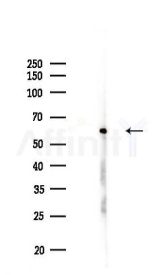 SNRP70 Antibody - Western blot analysis of lysates from EC304 cells(UV,30min treatment), using SNRP70 Antibody at 1/1000 dilution.