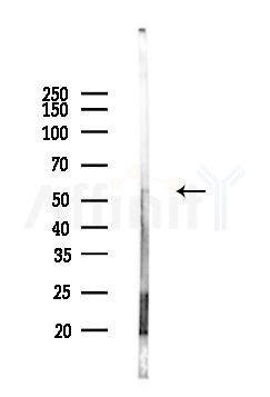 Ornithine Carbamoyltransferase Antibody - Western blot analysis of lysates from COLO205 cells(LPS, 4h treatment), using Ornithine Carbamoyltransferase Antibody at 1/1000 dilution.
