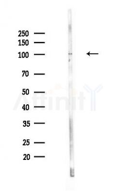 DISC1 Antibody - Western blot analysis of lysates from PC12 cells(UV,30min treatment), using DISC1 Antibody at 1/1000 dilution.