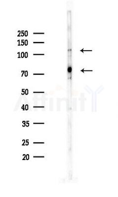 Kinesin 5 C Antibody - Western blot analysis of lysates from PC12 cells(UV,30min treatment), using Kinesin 5 C Antibody at 1/1000 dilution.