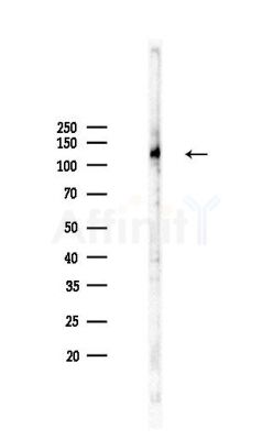 Kinesin 5 C Antibody - Western blot analysis of lysates from Rat brain, using Kinesin 5 C Antibody at 1/1000 dilution.