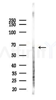 Steroid sulfatase Antibody - Western blot analysis of lysates from Mouse lung, using Steroid sulfatase Antibody at 1/1000 dilution.