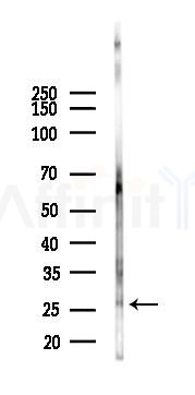 Nanos3 Antibody - Western blot analysis of lysates from Rat lung, using Nanos3 Antibody at 1/1000 dilution.