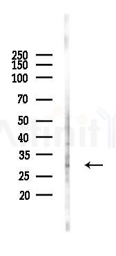 Nanos3 Antibody - Western blot analysis of lysates from 293 cells(UV,30min treatment), using Nanos3 Antibody at 1/1000 dilution.