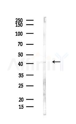 CD43 Antibody - Western blot analysis of lysates from Hela cells(heat-shock,45min treatment), using CD43 Antibody at 1/1000 dilution.