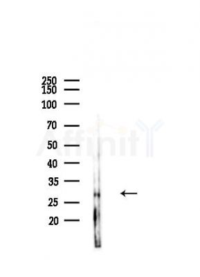 OVOL2 Antibody - Western blot analysis of lysates from Mouse liver, using OVOL2 Antibody at 1/1000 dilution.