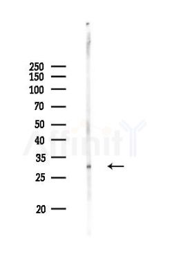 OVOL2 Antibody - Western blot analysis of lysates from Rat liver, using OVOL2 Antibody at 1/1000 dilution.