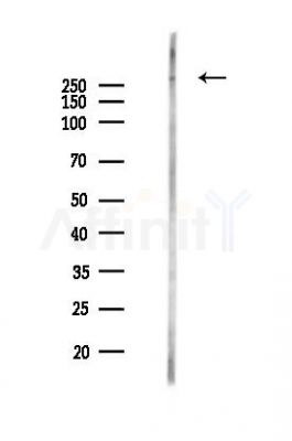 Filamin B Antibody - Western blot analysis of lysates from HUVEC cells(LPS,4h treatment), using Filamin B Antibody at 1/1000 dilution.