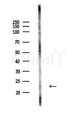 VPS29 Antibody - Western blot analysis of lysates from PC12 cells(heat-shock,45min treatment), using VPS29 Antibody at 1/1000 dilution.
