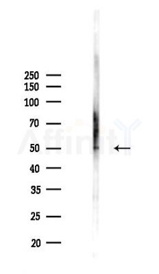 DHCR7 Antibody - Western blot analysis of lysates from B16F10-LUC cells(starvation,24h treatment), using DHCR7 Antibody at 1/1000 dilution.