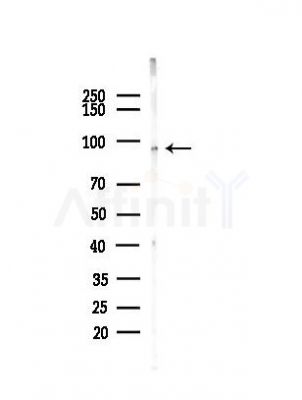 THRAP5 Antibody - Western blot analysis of lysates from EC304 cells(heat-shock,45min treatment), using THRAP5 Antibody at 1/1000 dilution.