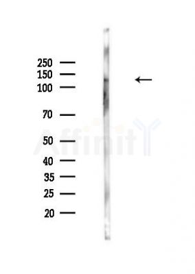 Anillin Antibody - Western blot analysis of lysates from Hela cells(heat-shock,45min treatment), using Anillin Antibody at 1/1000 dilution.