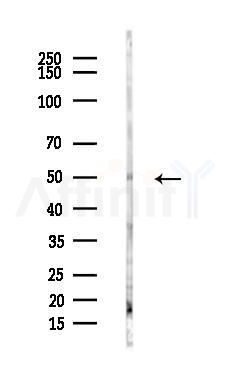 Nogo Receptor Antibody - Western blot analysis of lysates from Hela cells(heat-shock,45min treatment), using Nogo Receptor Antibody at 1/1000 dilution.