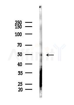 Nogo Receptor Antibody - Western blot analysis of lysates from Mouse liver, using Nogo Receptor Antibody at 1/1000 dilution.