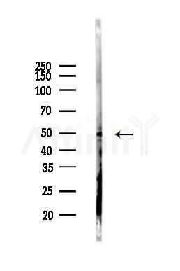 Nogo Receptor Antibody - Western blot analysis of lysates from COLO205 cells(LPS, 4h treatment), using Nogo Receptor Antibody at 1/1000 dilution.