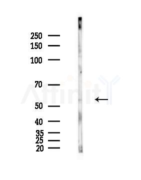 EAAT4 Antibody - Western blot analysis of lysates from PC12 cells(LPS,4h treatment), using EAAT4 Antibody at 1/1000 dilution.