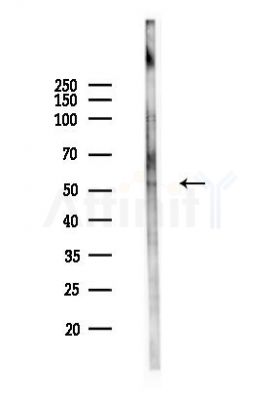 PRMT3 Antibody - Western blot analysis of lysates from PC12 cells(heat-shock,45min treatment), using PRMT3 Antibody at 1/1000 dilution.