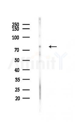 GGA3 Antibody - Western blot analysis of lysates from Hela cells(heat-shock,45min treatment), using GGA3 Antibody at 1/1000 dilution.