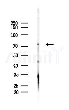 GGA3 Antibody - Western blot analysis of lysates from Mouse liver, using GGA3 Antibody at 1/1000 dilution.