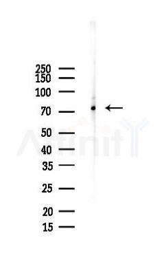 GGA3 Antibody - Western blot analysis of lysates from COLO205 cells(LPS, 4h treatment), using GGA3 Antibody at 1/1000 dilution.