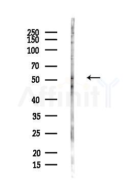 Melanopsin Antibody - Western blot analysis of lysates from Hela cells(heat-shock,45min treatment), using Melanopsin Antibody at 1/1000 dilution.