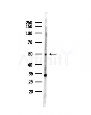 Repulsive Guidance Molecule A Antibody - Western blot analysis of lysates from Mouse liver, using Repulsive Guidance Molecule A Antibody at 1/1000 dilution.