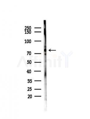 PARN Antibody - Western blot analysis of lysates from EC304 cells(heat-shock,45min treatment), using PARN Antibody at 1/1000 dilution.