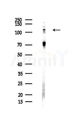 E1 Ubiquitin Activating Enzyme Antibody - Western blot analysis of lysates from Hela cells(heat-shock,45min treatment), using E1 Ubiquitin Activating Enzyme Antibody at 1/1000 dilution.