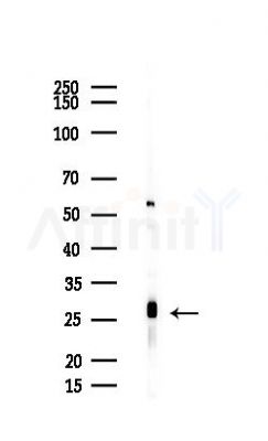 SOX14 Antibody - Western blot analysis of lysates from Mouse liver, using SOX14 Antibody at 1/1000 dilution.