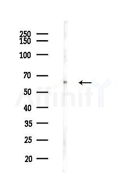 Glucose 6 phosphate isomerase Antibody - Western blot analysis of lysates from Hela cells(heat-shock,45min treatment), using Glucose 6 phosphate isomerase Antibody at 1/1000 dilution.