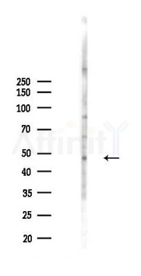 RECQL5 Antibody - Western blot analysis of lysates from HepG2 cells(heat-shock,45min treatment), using RECQL5 Antibody at 1/1000 dilution.