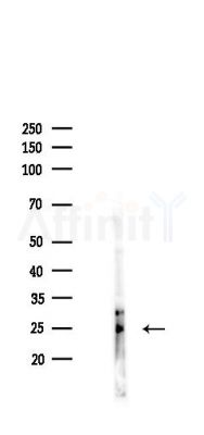 HB EGF Antibody - Western blot analysis of lysates from Hela cells(LPS,4h treatment), using HB EGF Antibody at 1/1000 dilution.