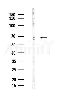TBKBP1 Antibody - Western blot analysis of lysates from Hela cells(heat-shock,45min treatment), using TBKBP1 Antibody at 1/1000 dilution.