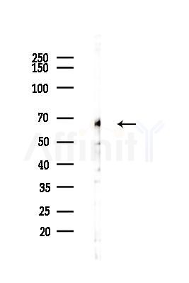 CARM1 Antibody - Western blot analysis of lysates from Hela cells(heat-shock,45min treatment), using CARM1 Antibody at 1/1000 dilution.
