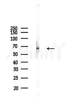 CARM1 Antibody - Western blot analysis of lysates from PC12 cells, using CARM1 Antibody at 1/1000 dilution.