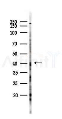 Snx6 Antibody - Western blot analysis of lysates from 293 cells(UV,30min treatment), using Snx6 Antibody at 1/1000 dilution.