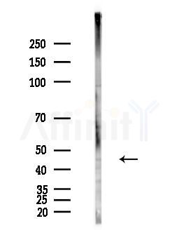 SPRED2 Antibody - Western blot analysis of lysates from Hela cells(heat-shock,45min treatment), using SPRED2 Antibody at 1/1000 dilution.