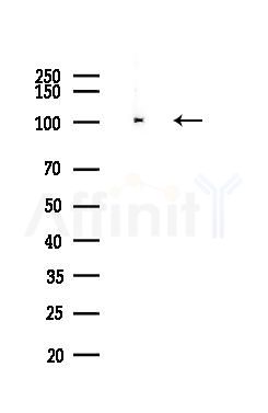 ITIH1 Antibody - Western blot analysis of lysates from Hela cells(heat-shock,45min treatment), using ITIH1 Antibody at 1/1000 dilution.