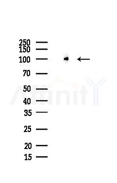 ITIH1 Antibody - Western blot analysis of lysates from COLO205 cells(LPS, 4h treatment), using ITIH1 Antibody at 1/1000 dilution.