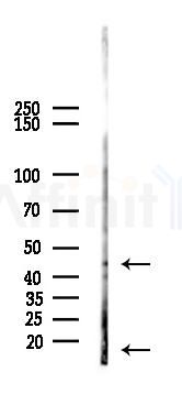 UXT Antibody - Western blot analysis of lysates from EC304 cells(UV,30min treatment), using UXT Antibody at 1/1000 dilution.