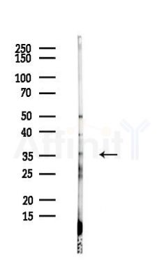 SCAMP2 Antibody - Western blot analysis of lysates from Hela cells(heat-shock,45min treatment), using SCAMP2 Antibody at 1/1000 dilution.