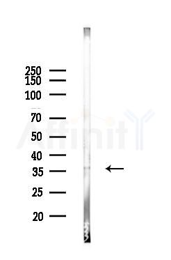SCAMP2 Antibody - Western blot analysis of lysates from PC12 cells, using SCAMP2 Antibody at 1/1000 dilution.